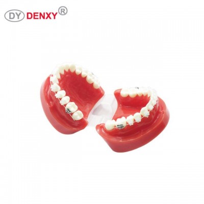 Denxy Dental Orthodontics Teeth Model Metal Brace bracket Typodont with Arch Wire