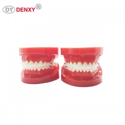 Denxy Dental Teeth Models,Dental Model,Dental Orthodontics Model