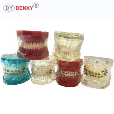 Denxy dental teeth model brackets orthodontics tooth model