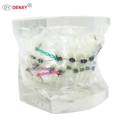 Denxy Dental High Quality Orthodontic Training Typodont With Metal Brackets Orthodontic Model