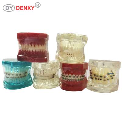 Denxy dental teeth typodont orthodontic dental model with all ceramic bracket