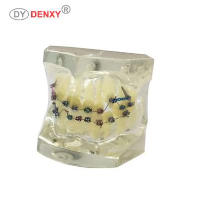 Hot sale dental education models tooth model with archwire bracket