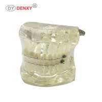 Denxy Dental ceramic orthodontic brackets tooth model